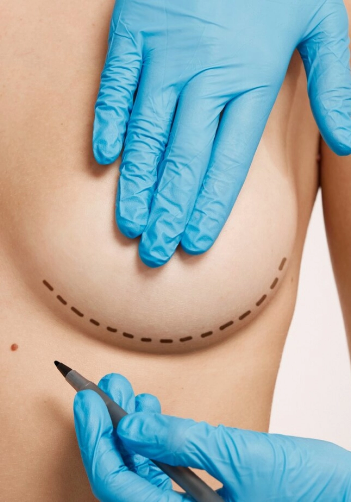 Breast Surgery